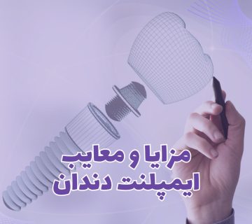 بررسی مزایا و معایب ایمپلنت دندان در بیماران مختلف و مقایسه با بریج و روکش توسط دکتر نگین واعظی در تبریز