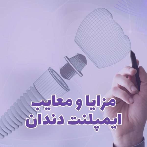 بررسی مزایا و معایب ایمپلنت دندان در بیماران مختلف و مقایسه با بریج و روکش توسط دکتر نگین واعظی در تبریز