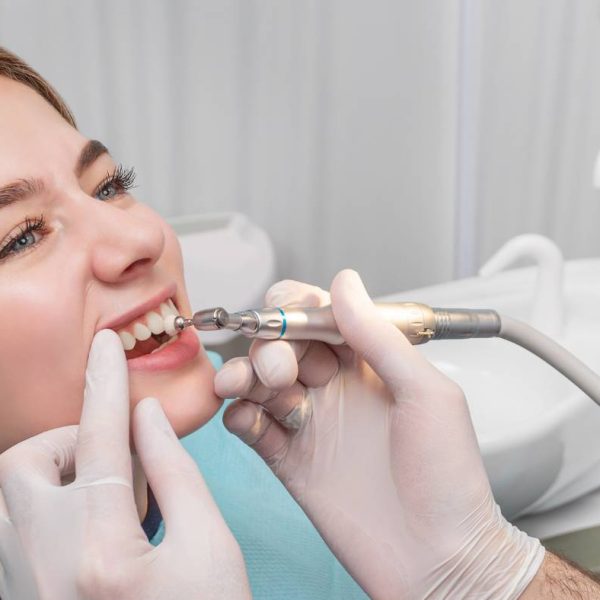 پولیش کامپوزیت در تبریز یا پولیش بعد از کامپوزیت دندان توسط دکتر نگین واعظی