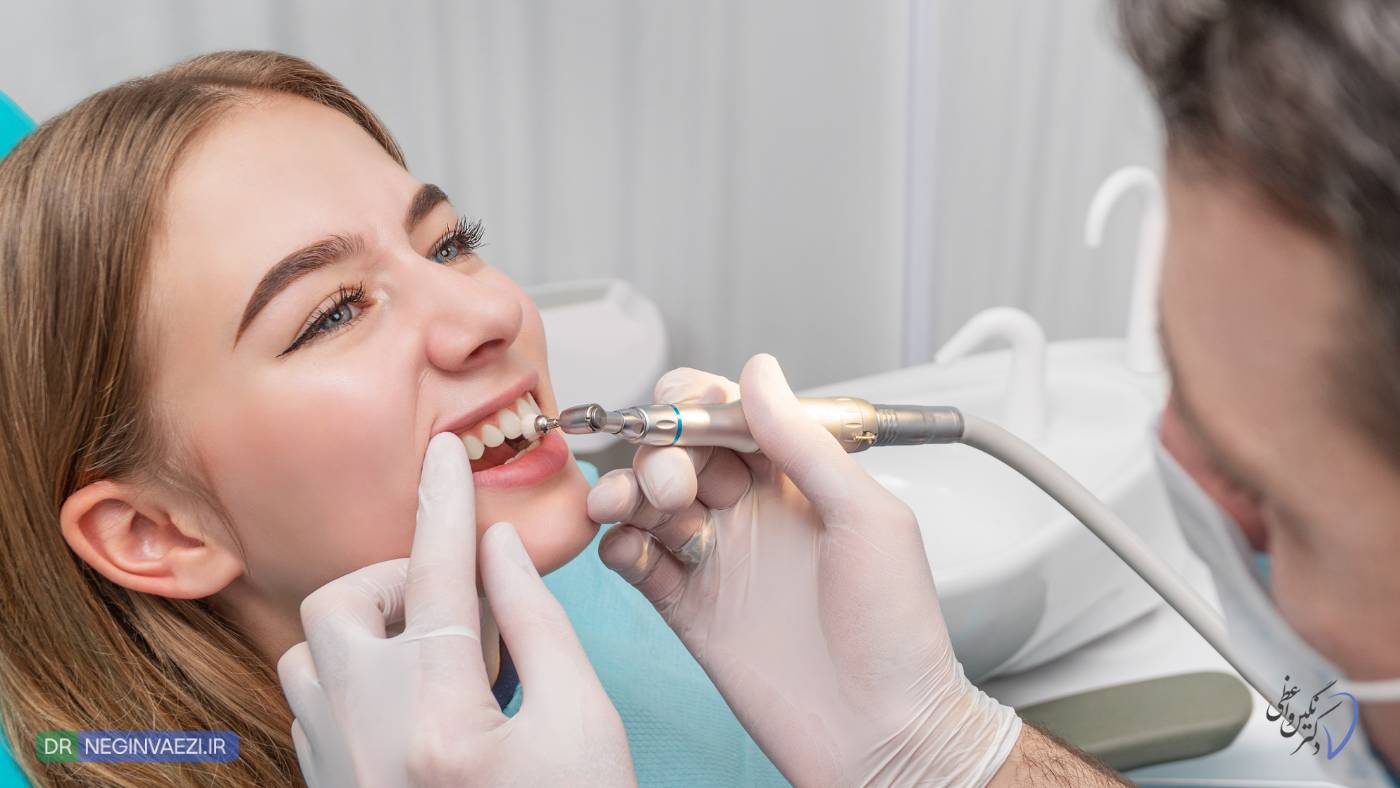 پولیش کامپوزیت در تبریز یا پولیش بعد از کامپوزیت دندان توسط دکتر نگین واعظی