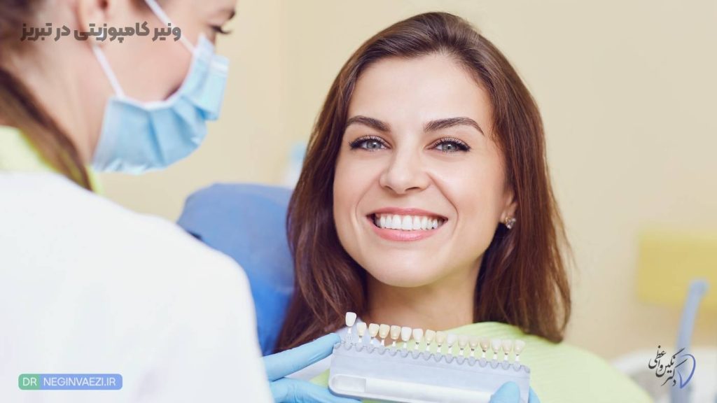 پولیش ونیر کامپوزیت در تبریز,پالیش کامپوزیت در تبریز قبل و بعد