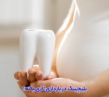 بلیچینگ دندان در بارداری و شیردهی خطرناک است؟ پاسخ از دکتر نگین واعظی دندانپزشک در تبریز