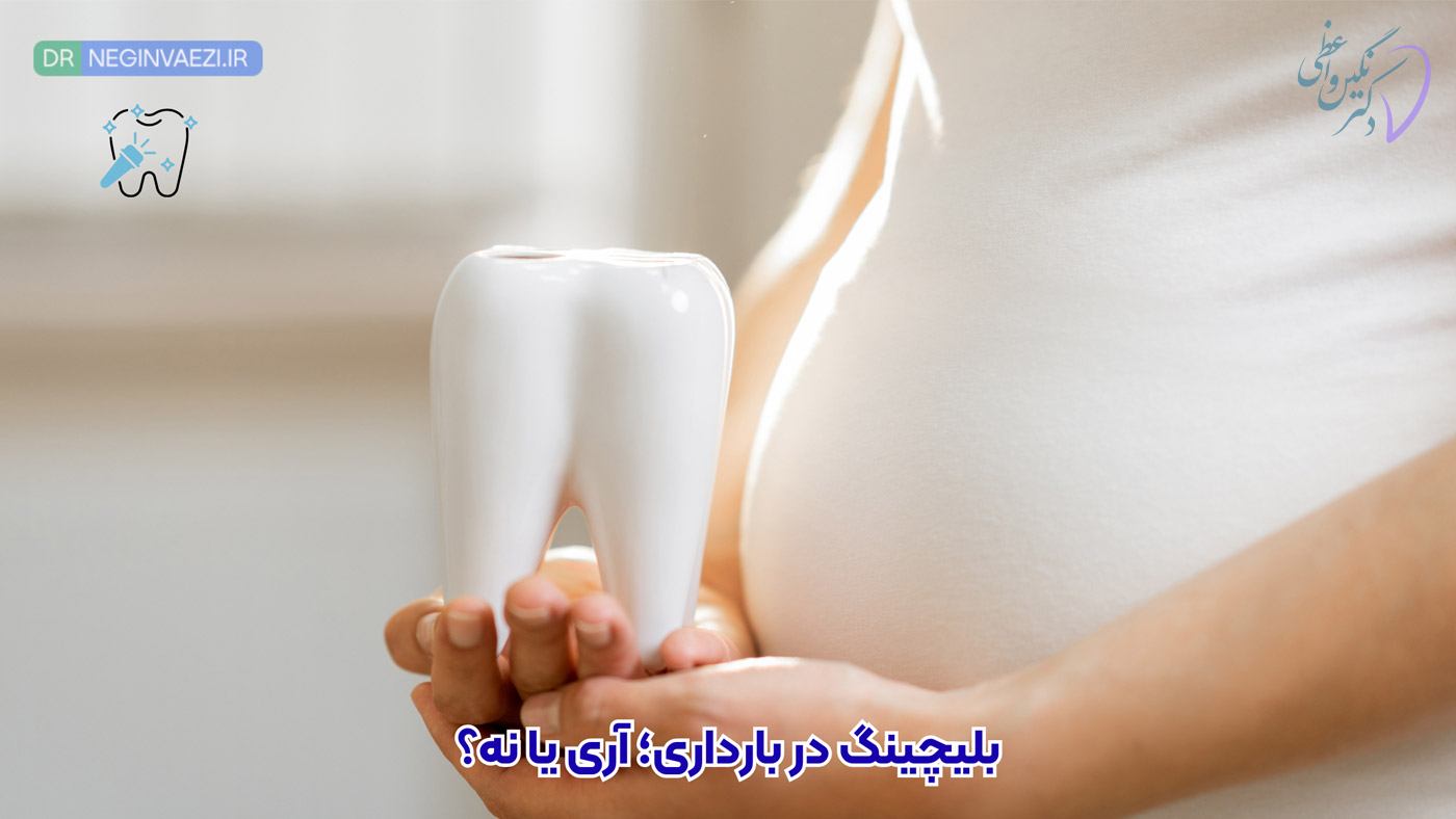 بلیچینگ دندان در بارداری و شیردهی خطرناک است؟ پاسخ از دکتر نگین واعظی دندانپزشک در تبریز