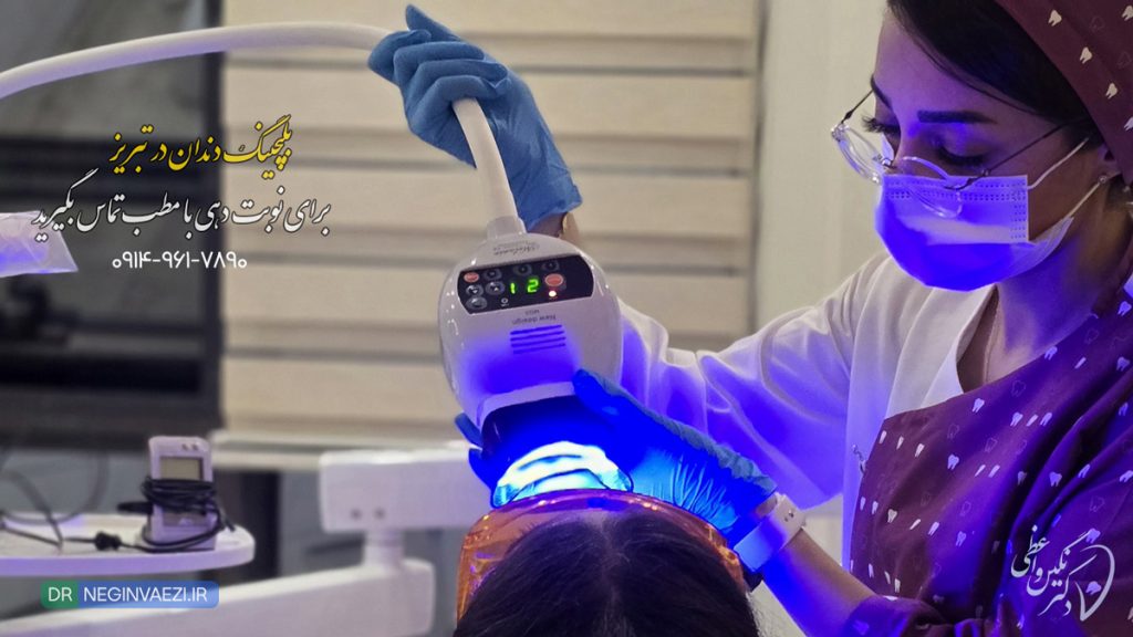 بلیچینگ دندان در تبریز توسط دکتر نگین واعظی با قیمت و هزینه مناسب و نوبت دهی سریع مطب ولیعصر