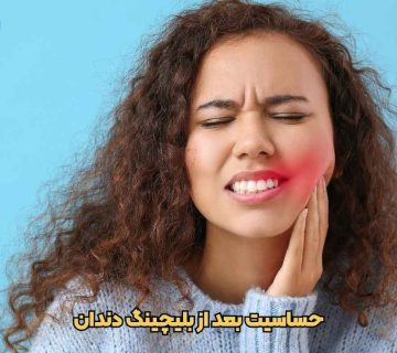 حساسیت بعد از بلیچینگ دندان در تبریز ، راهکارها توسط دکتر نگین واعظی