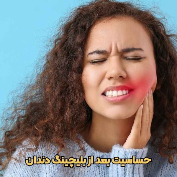 حساسیت بعد از بلیچینگ دندان در تبریز ، راهکارها توسط دکتر نگین واعظی