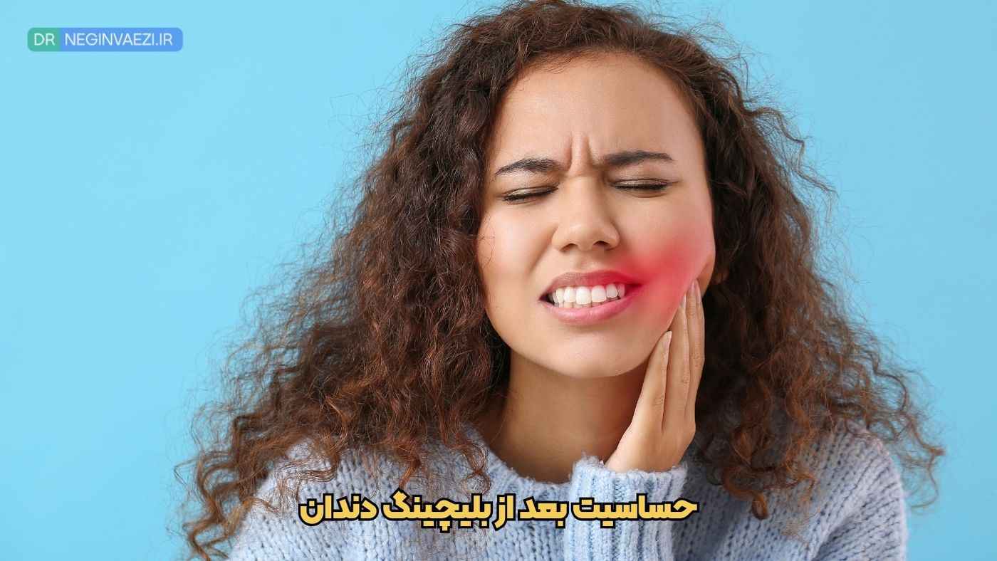 حساسیت بعد از بلیچینگ دندان در تبریز ، راهکارها توسط دکتر نگین واعظی