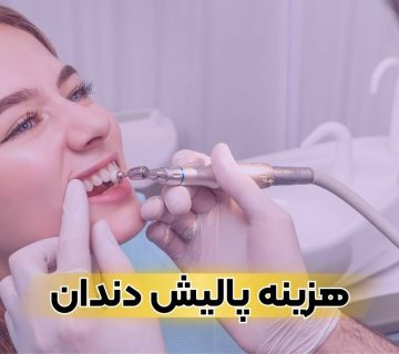 هزینه پولیش دندان کامپوزیت شده در تبریز سال ۱۴۰۴ چقدر است؟