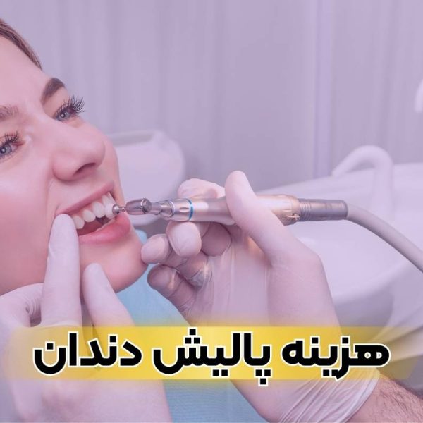 هزینه پولیش دندان کامپوزیت شده در تبریز سال ۱۴۰۴ چقدر است؟