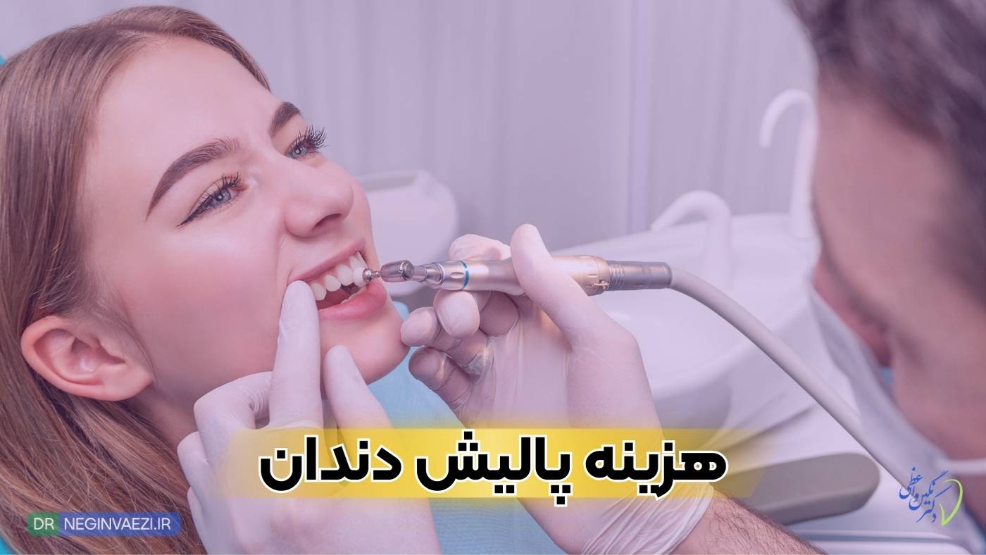 هزینه پولیش دندان کامپوزیت شده در تبریز سال ۱۴۰۴ چقدر است؟