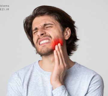 مشکلات شایع دندانی و روش های درمان اعم از دندان درد پوسیدگی دندان نهفته لب پریدگی براکسیسم و ...