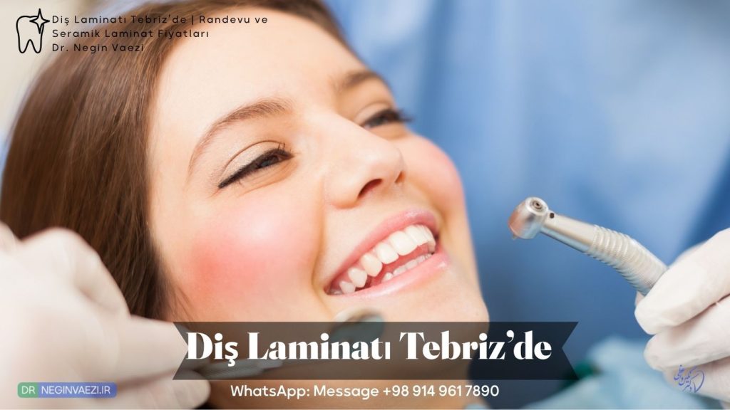 Diş laminatı Tebriz’de, seramik laminat, diş estetiği, laminat fiyatı