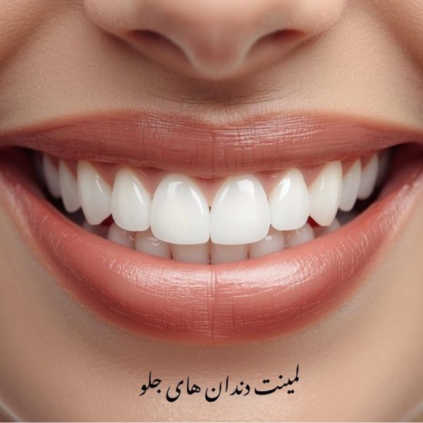بهترین دندانپزشک لمینت دندان جلو در تبریز - سرامییک و emax