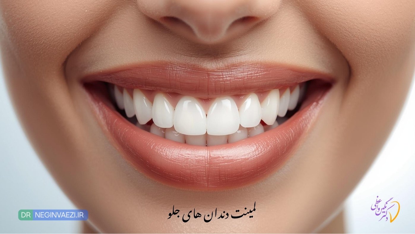 بهترین دندانپزشک لمینت دندان جلو در تبریز - سرامییک و emax