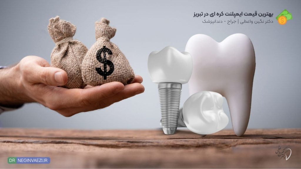 قیمت ایمپلنت کره ای دنتیس و مگاژن در تبریز ولیعصر