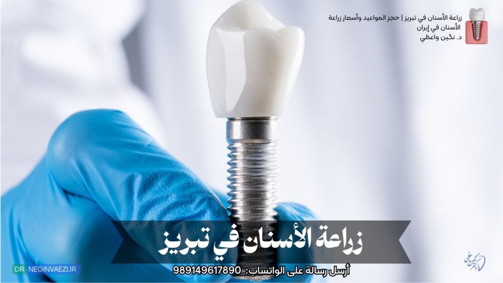 زراعة الأسنان في ایران تبریز بأسعار مناسبة وجودة عالية