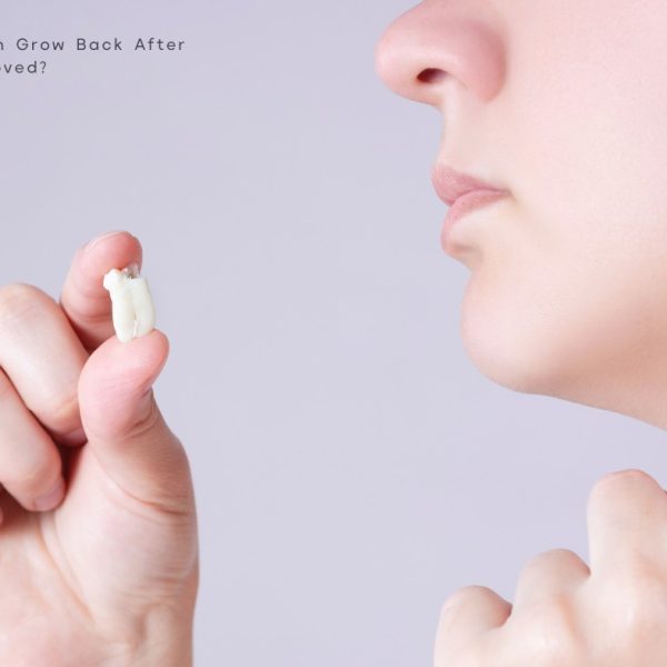 آیا دندان عقل بعد از کشیدن دوباره رشد می‌کند؟ کشیدن و جراحی دندان عقل نهفته و نیمه نهفته در تبریز