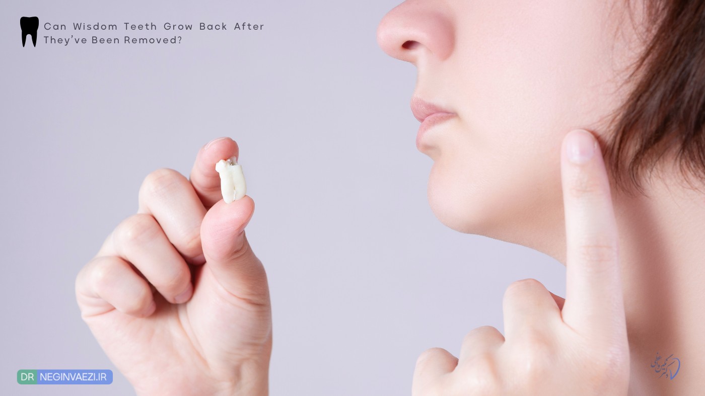 آیا دندان عقل بعد از کشیدن دوباره رشد میکند؟ کشیدن و جراحی دندان عقل نهفته و نیمه نهفته در تبریز