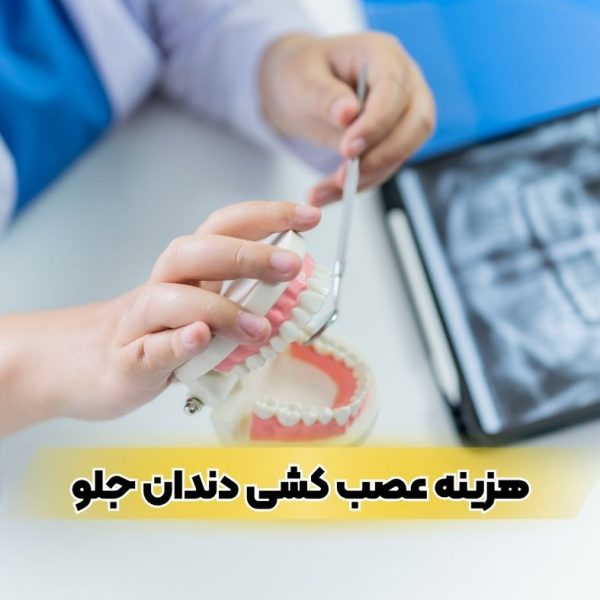 هزینه عصب کشی دندان جلو در تبریز ۱۴۰۴ | مراحل درمان، دلایل و عوارض عدم درمان