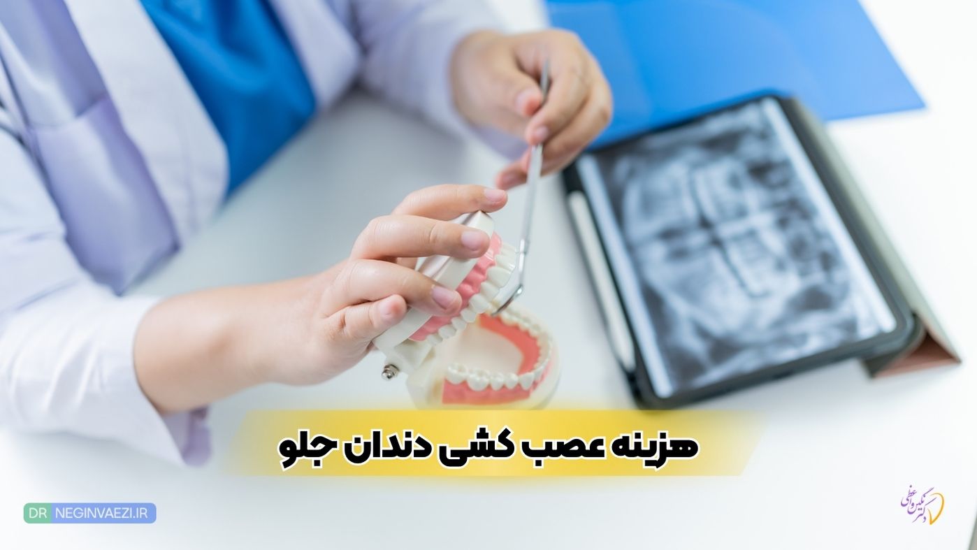 هزینه عصب کشی دندان جلو در تبریز ۱۴۰۴ | مراحل درمان، دلایل و عوارض عدم درمان