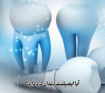 درد بعد از ایمپلنت دندان، کاشت ایمپلنت بدون درد، کاهش درد ایمپلنت، درد ایمپلنت تا چند روز، آیا ایمپلنت دندان درد دارد؟