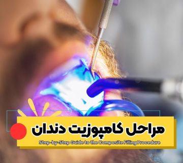 مراحل کامپوزیت دندان روش انجام کامپوزیت دندان فرایند کامپوزیت دندان کامپوزیت چگونه انجام می‌شود مراحل ترمیم دندان با کامپوزیت مراحل لایه‌گذاری کامپوزیت