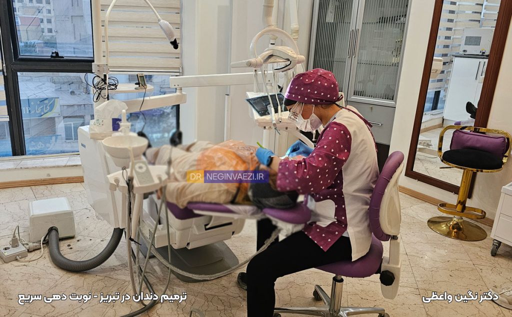 ترمیم کامپوزیت دندان در تبریز ولیعصر دکتر نگین واعظی