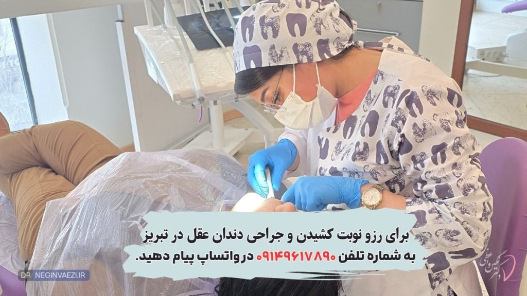 کشیدن دندان عقل در تبریز , جراحی دندان عقل در تبریز, دکتر نگین واعظی جراح و دندانپزشک ولیعصر تبریز