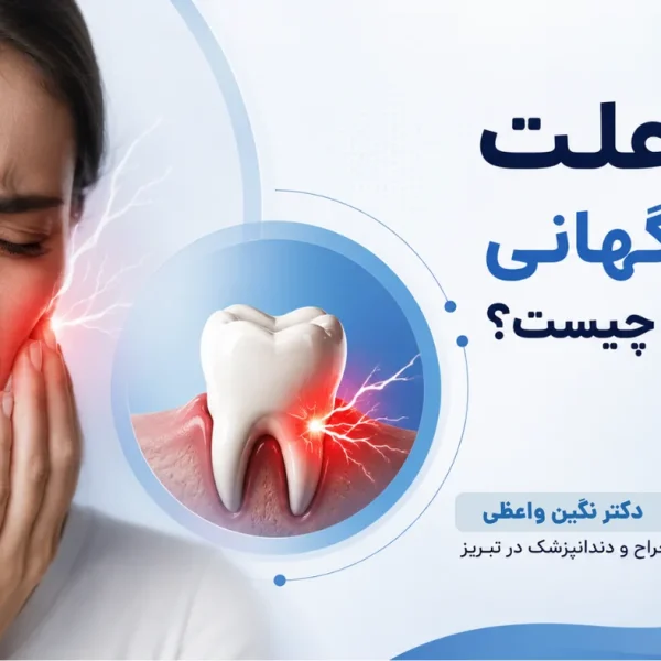 علت درد ناگهانی همه دندان‌ها و حساسیت دندان