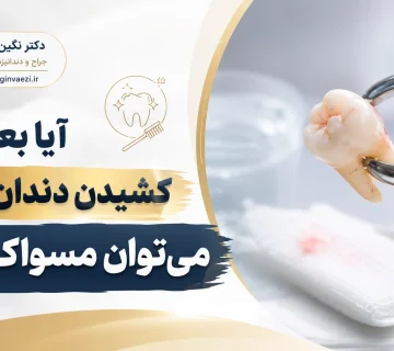 مسواک بعد از کشیدن دندان عقل و مراقبت از محل جراحی