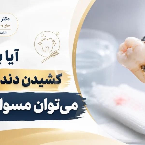 مسواک بعد از کشیدن دندان عقل و مراقبت از محل جراحی