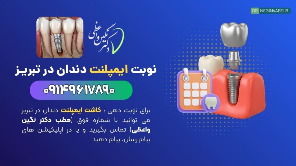نوبت فوری دکتر ایمپلنت در تبریز   مطب دکتر نگین واعظی ولیعصر