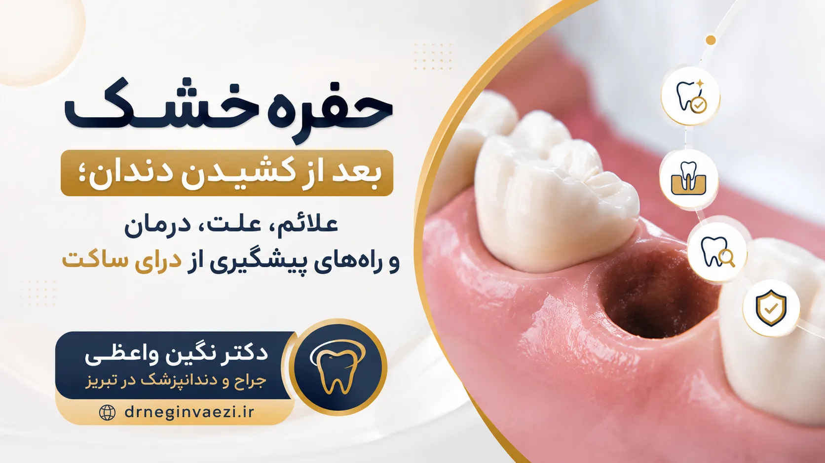حفره خشک بعد از کشیدن دندان؛ علائم و درمان درای ساکت Dry socket