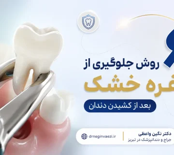 ۶ روش جلوگیری از حفره خشک بعد از کشیدن دندان و پیشگیری از درای ساکت