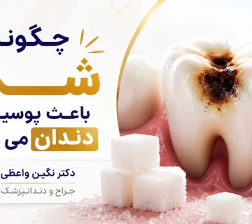 How Sugar Causes Cavities dr negin vaezi tabriz 360x320