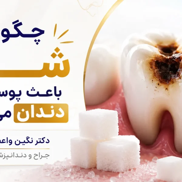 How Sugar Causes Cavities dr negin vaezi tabriz 600x600
