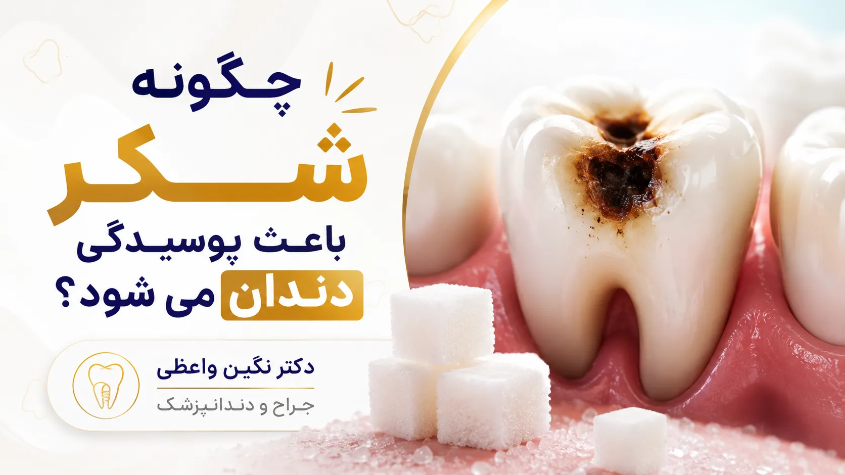 How Sugar Causes Cavities dr negin vaezi tabriz