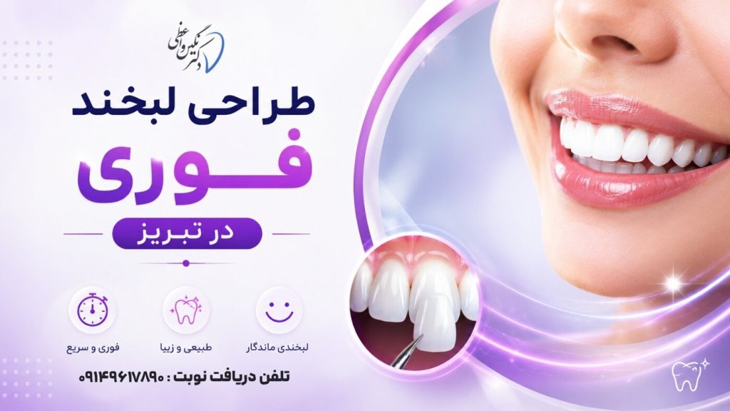 طراحی لبخند فوری در تبریز ولیعصر دکتر نگین واعظی