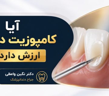 Dental composit veneer dr neginvaezi tabriz 09149617890 360x320