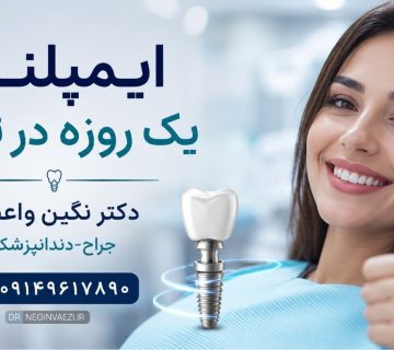 نوبت ایمپلنت یک روزه در تبریز منطقه ولیعصر | دکتر نگین واعظی