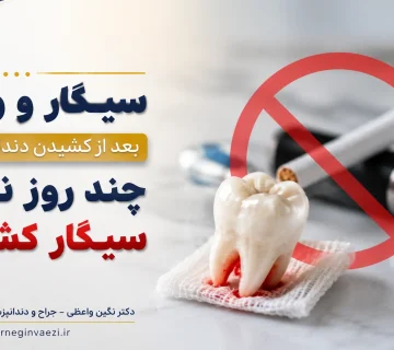 سیگار و ویپ بعد از کشیدن دندان عقل و خطر درای ساکت