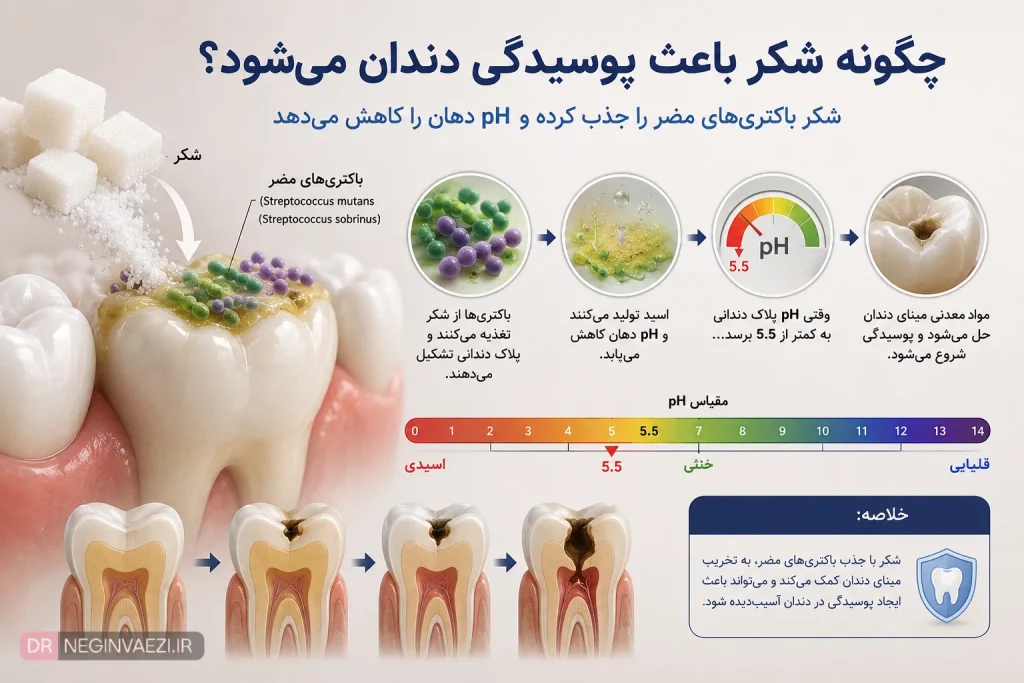 چگونه شکر با کاهش pH دهان و افزایش باکتری‌های مضر باعث پوسیدگی دندان می‌شود