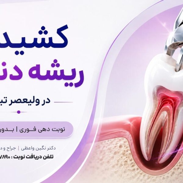 جراحی و کشیدن ریشه شکسته دندان در تبریز   کشیدن ریشه باقی مانده دندان دکتر نگین واعظی ولیعصر تبریز هزینه قیمت و مراحل