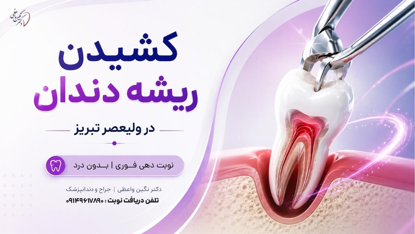 جراحی و کشیدن ریشه شکسته دندان در تبریز   کشیدن ریشه باقی مانده دندان دکتر نگین واعظی ولیعصر تبریز هزینه قیمت و مراحل