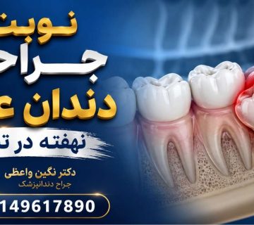 Wisdom tooth surgery drneginvaezi tabriz 09149617890 360x320