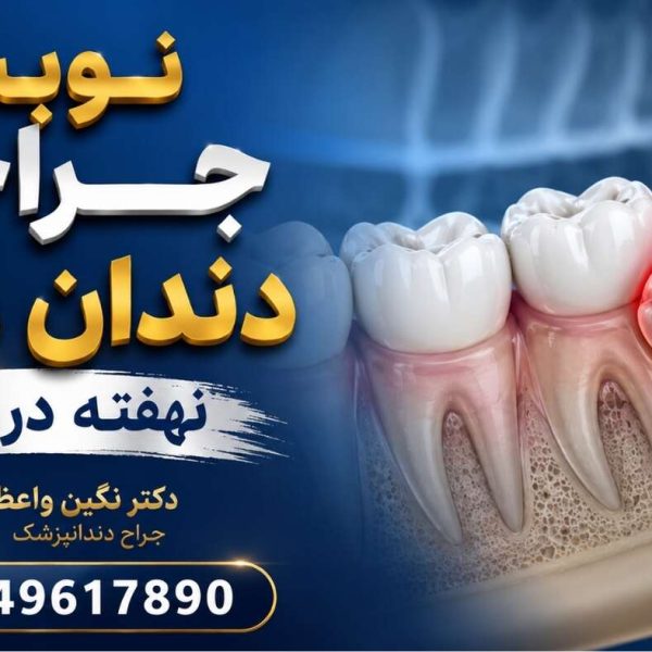 Wisdom tooth surgery drneginvaezi tabriz 09149617890 600x600