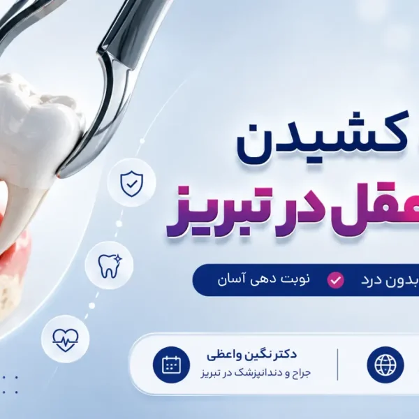 نوبت کشیدن دندان عقل در تبریز، جراحی دندان عقل بدون درد توسط دکتر نگین واعظی