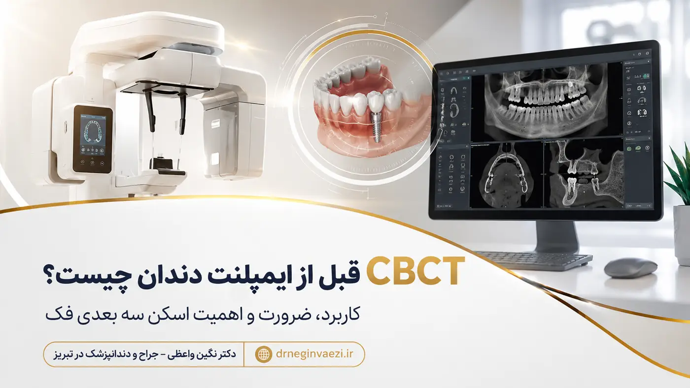 عکس CBCT قبل از ایمپلنت دندان و بررسی سه بعدی استخوان فک