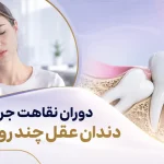 دوران نقاهت جراحی دندان عقل