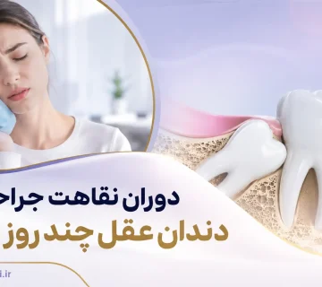 دوران نقاهت جراحی دندان عقل